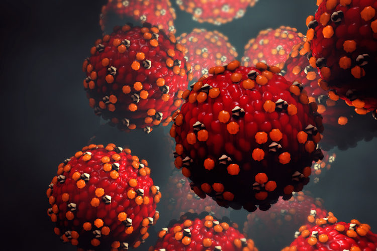 Infecções virais podem ter relação com o desenvolvimento de mielite transversa.