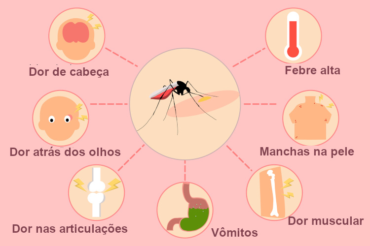  Alguns sintomas que podem surgir na fase febril da dengue.