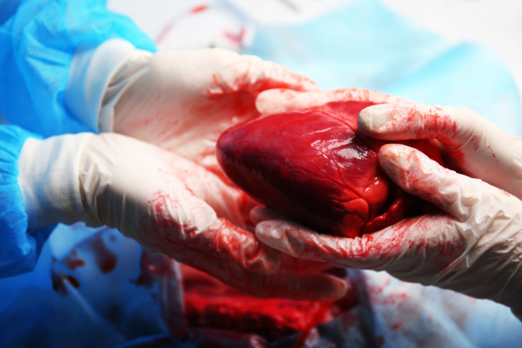 O coração é um dos órgãos que pode ser doado por doador falecido.
