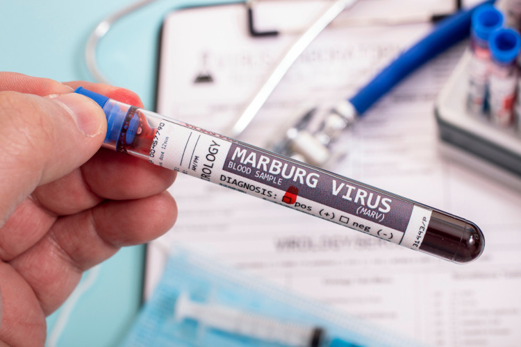 Os primeiros casos da doença do vírus de Marburg foram identificados em 1967.