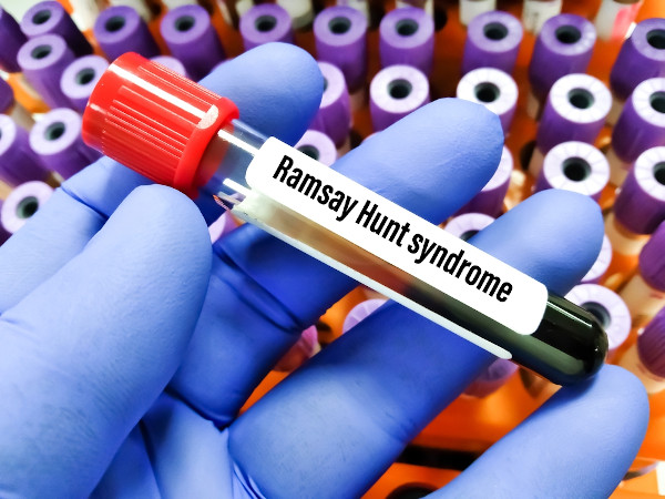 Mão segurando tubo em que está escrito “Ramsay Hunt syndrome”