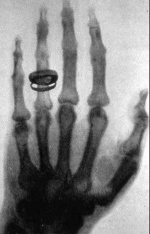Primeira imagem de raio X. 