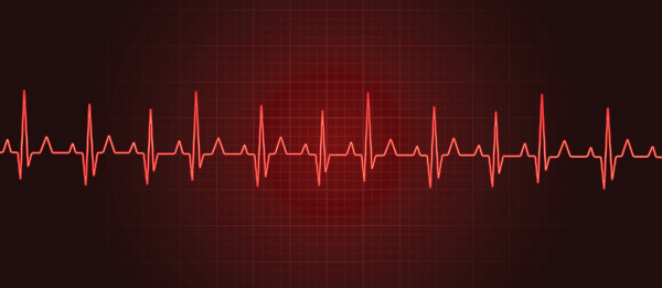 Representação de batimentos cardíacos, um tipo de onda periódica.
