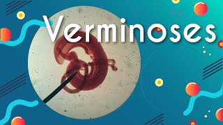 Ilustração de um verme em fundo azul com escrito"Verminoses: doenças causadas por vermes".