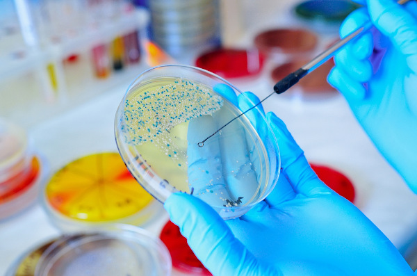 Mãos humanas com luvas, segurando um recipiente com micro-organismos, objetos de estudo da microbiologia, em um laboratório.