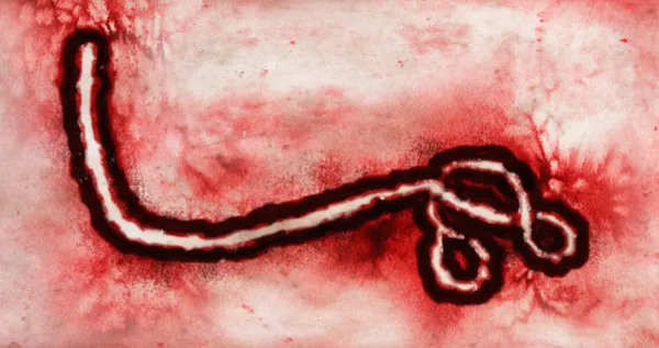 Vírus Ebola