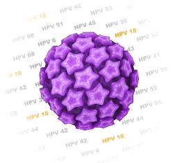 O HPV do tipo 16 e 18 está presente em diversos casos de câncer do colo do útero