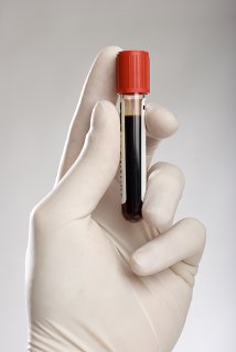O sangue humano contém soluções-tampão que mantêm o seu pH em torno de 7,4