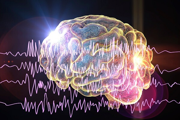 A epilepsia acontece devido a sinais incorretos emitidos pelo cérebro.
