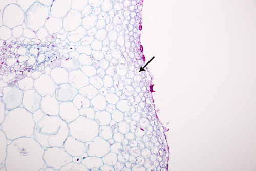 As células do colênquima compõem um tecido relacionado com a sustentação da planta