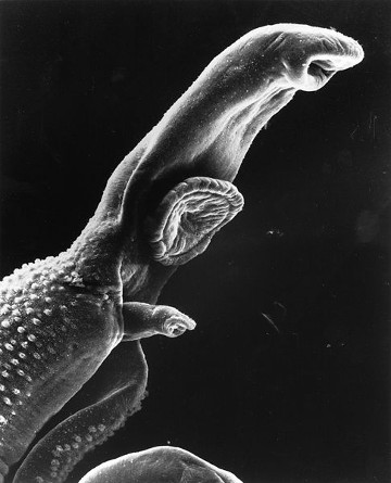 O Schistosoma mansoni  é responsável por causar a esquistossomose mansônica