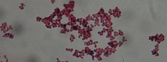 Malassezia furfur: fungo responsável pela pitiríase versicolor, também chamada de pano branco.