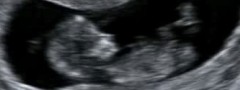 Ultrassom de bebê humano: resultado da reprodução sexuada.