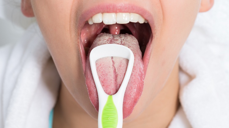 A limpeza da língua com limpadores evita a formação da saburra