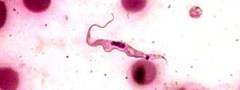 Trypanosoma cruzi: protozoário responsável pela doença de Chagas