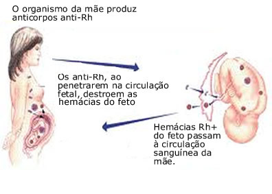 Representação do processo da sensibilização de uma mulher Rh- por um feto Rh+