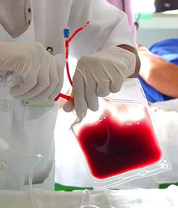 Os problemas causados pela transfusão de sangue são raros