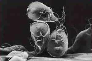 Giardia lamblia: protozoário flagelado responsável pela giardíase.