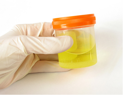 A cor amarela da urina é conferida pelos urobilogênios