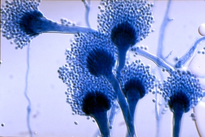 Aspergullus fumigatus: fungo frequentemente associado à aspergilose pulmonar.