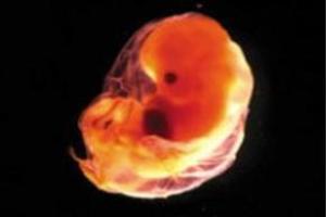Aborto: interrupção da gravidez.