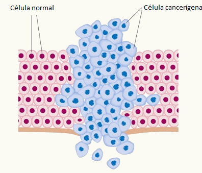 O câncer caracteriza-se pela multiplicação de células de maneira descontrolada